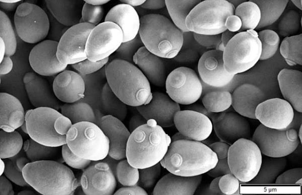 Electron microscopy image of yeast cells